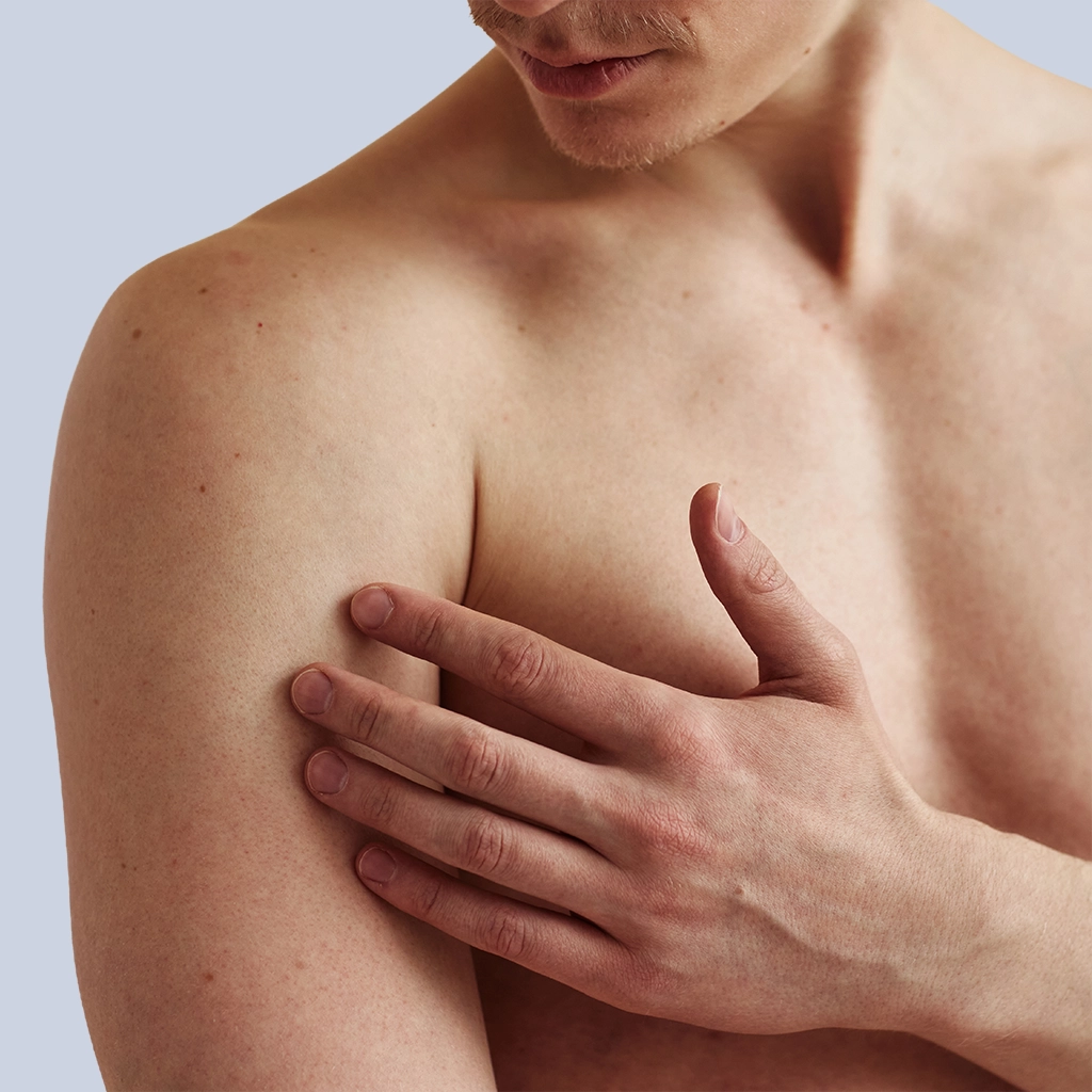Gynaecomastia purple